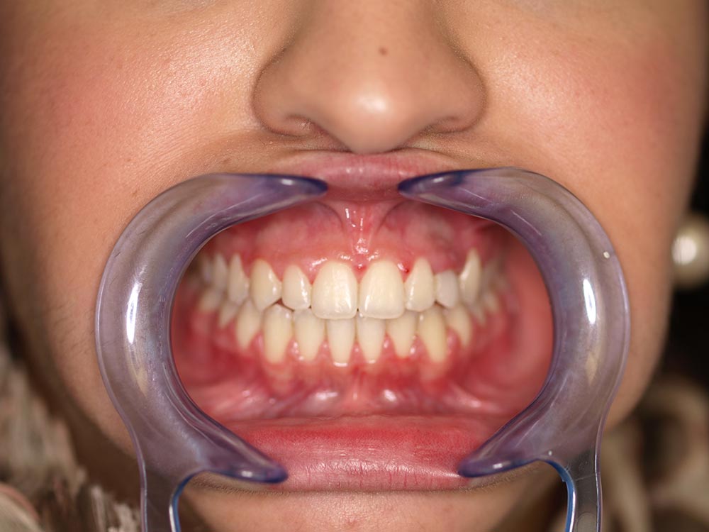 Orthodontic cases