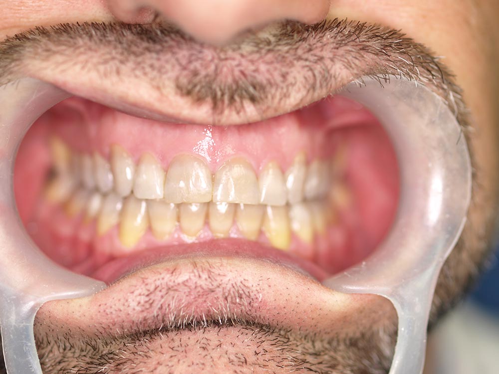 Orthodontic cases