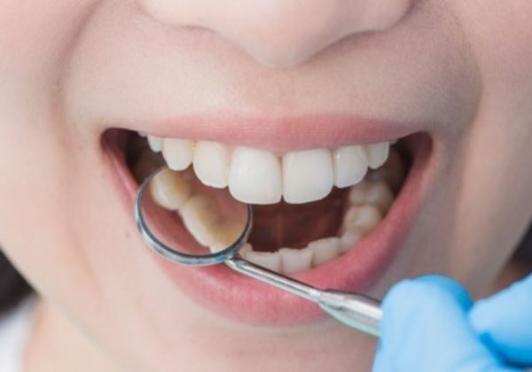 Eight million Spanish adults have some type of periodontal disease