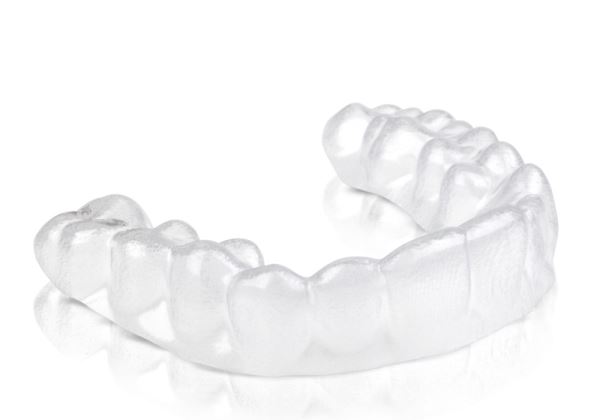 5 BENEFITS OF INVISALIGN