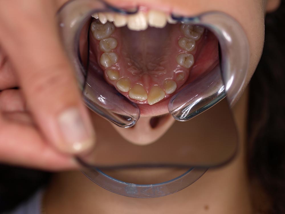 Orthodontic cases