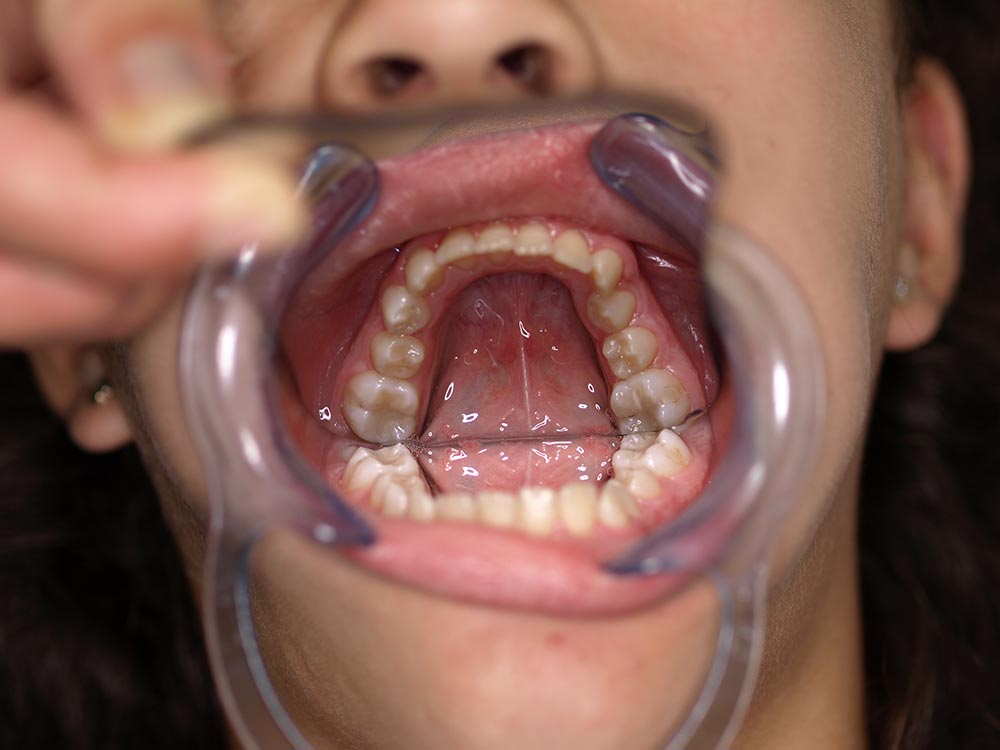 Orthodontic cases