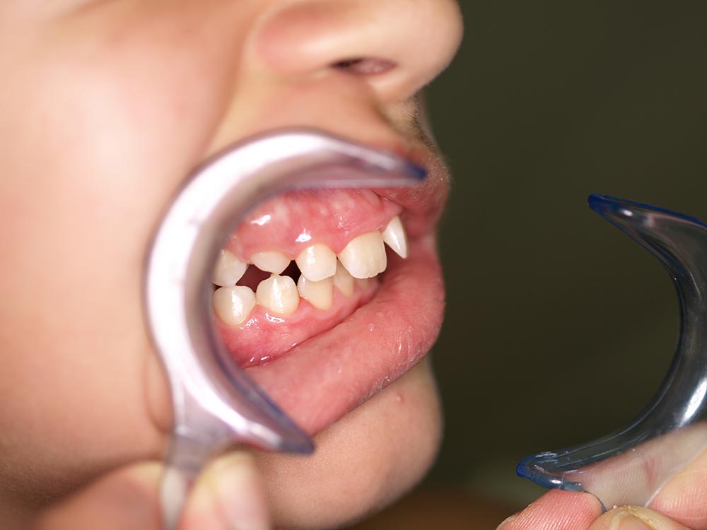 Orthodontic cases