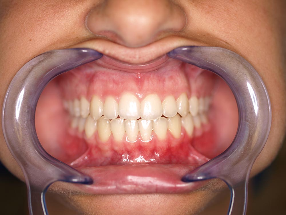 Casos de ortodoncia