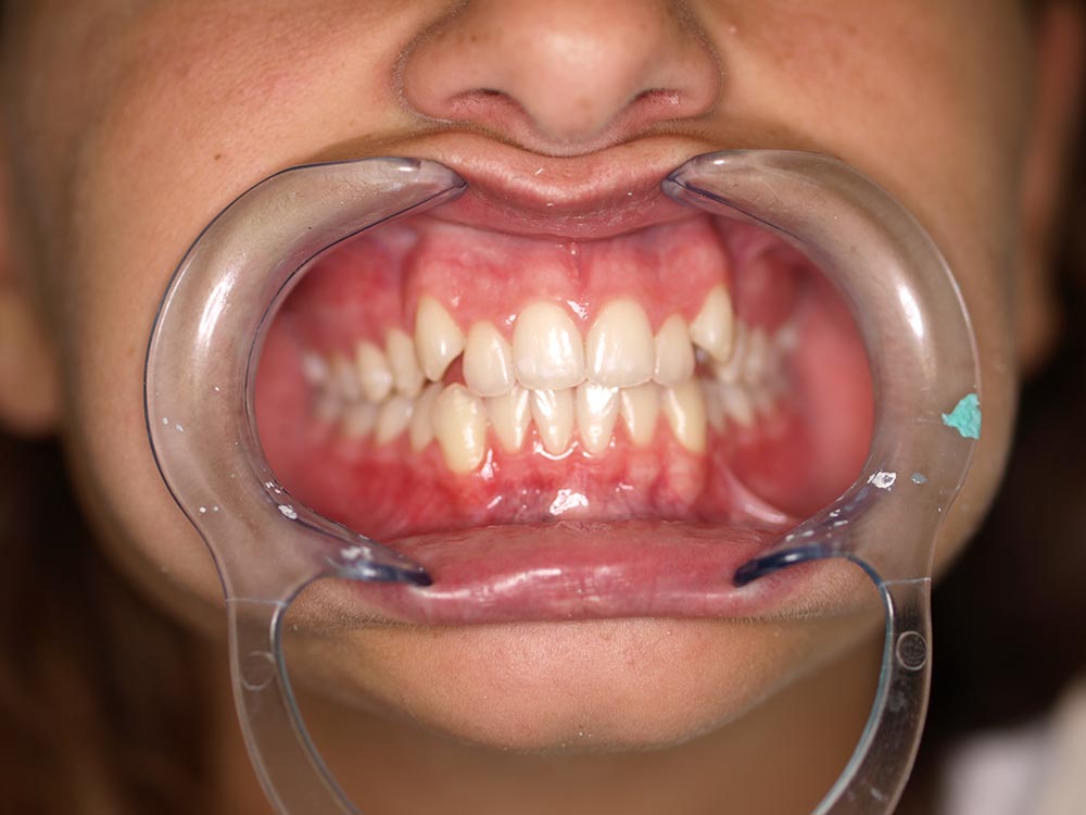 Orthodontic cases