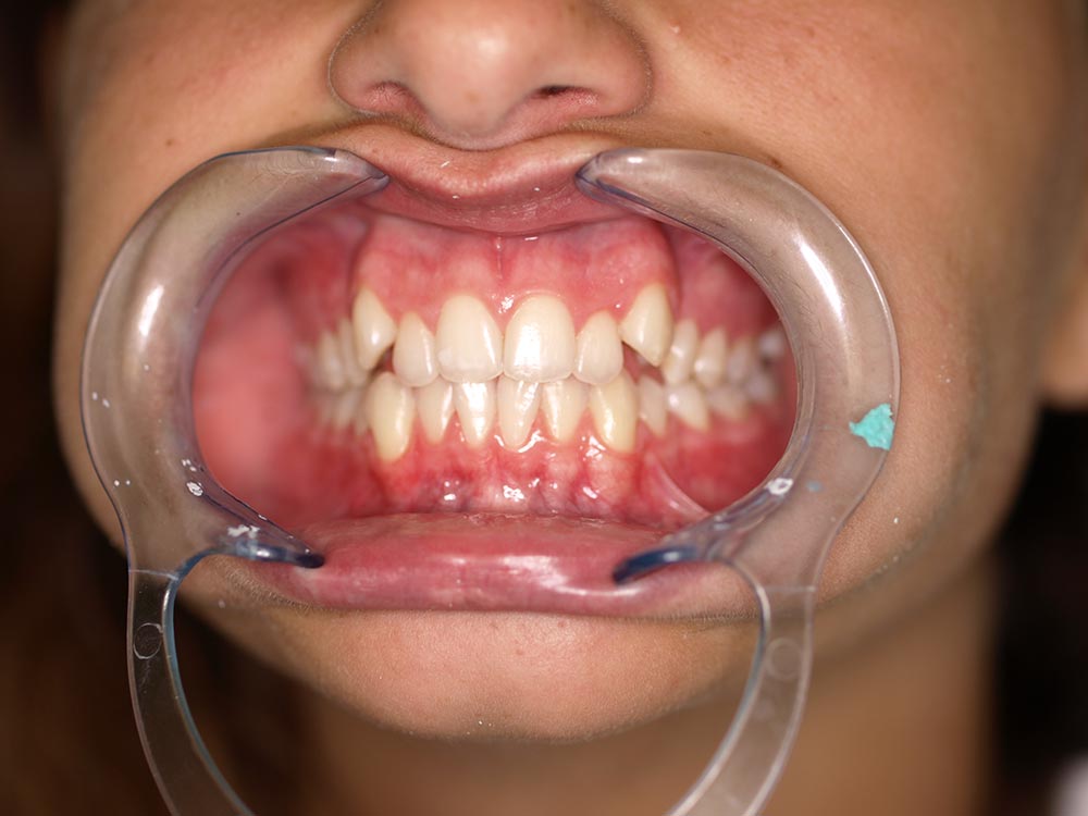 Orthodontic cases