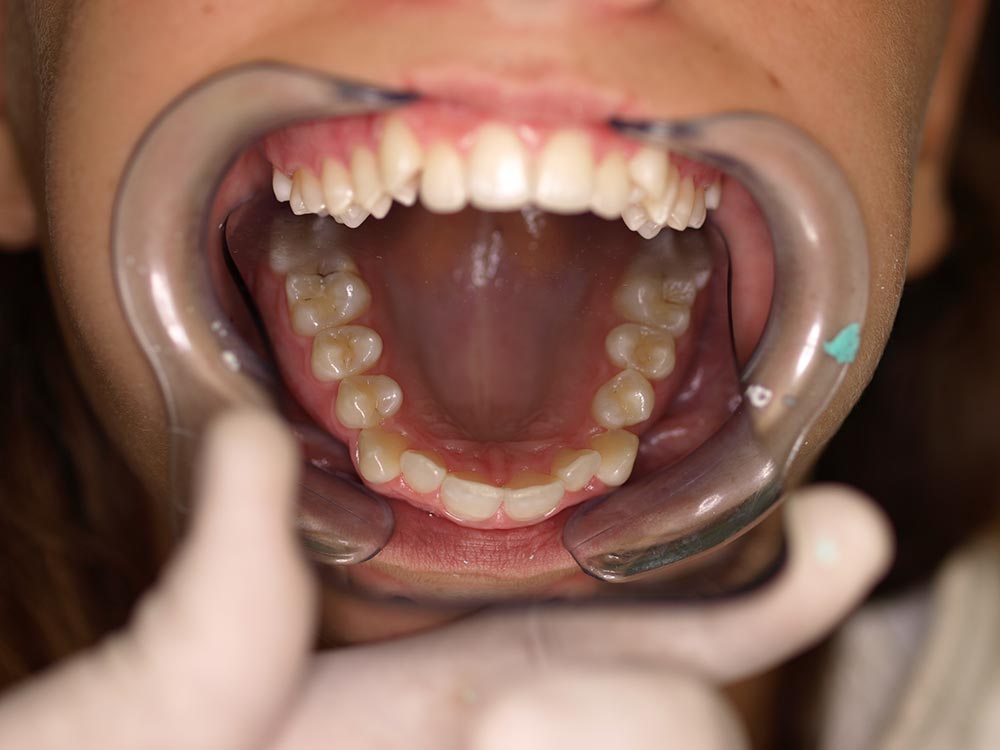 Orthodontic cases