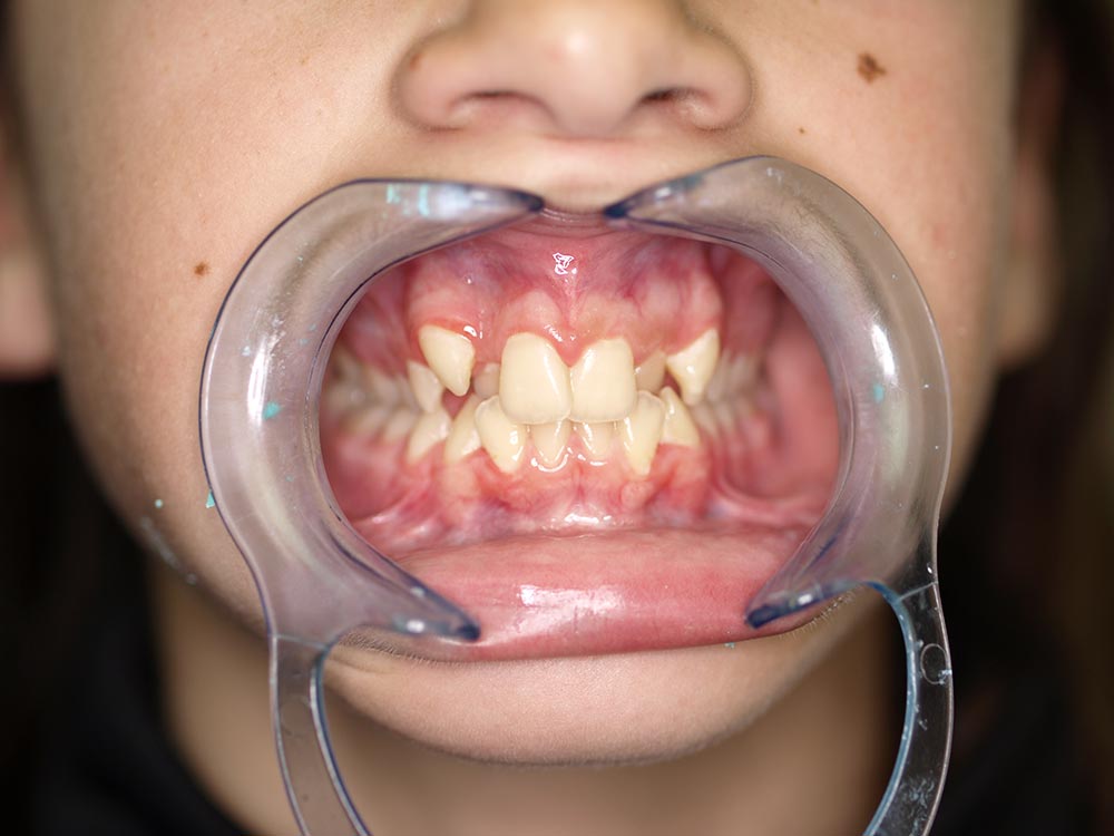 Orthodontic cases