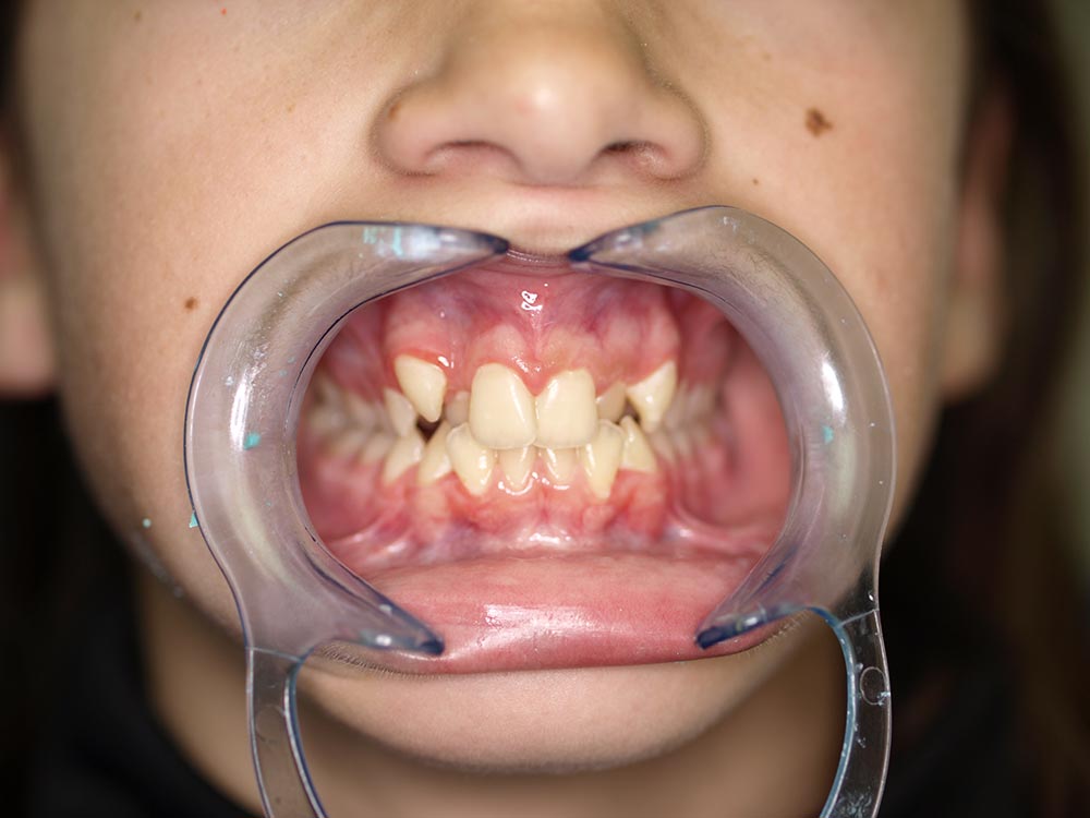 Orthodontic cases