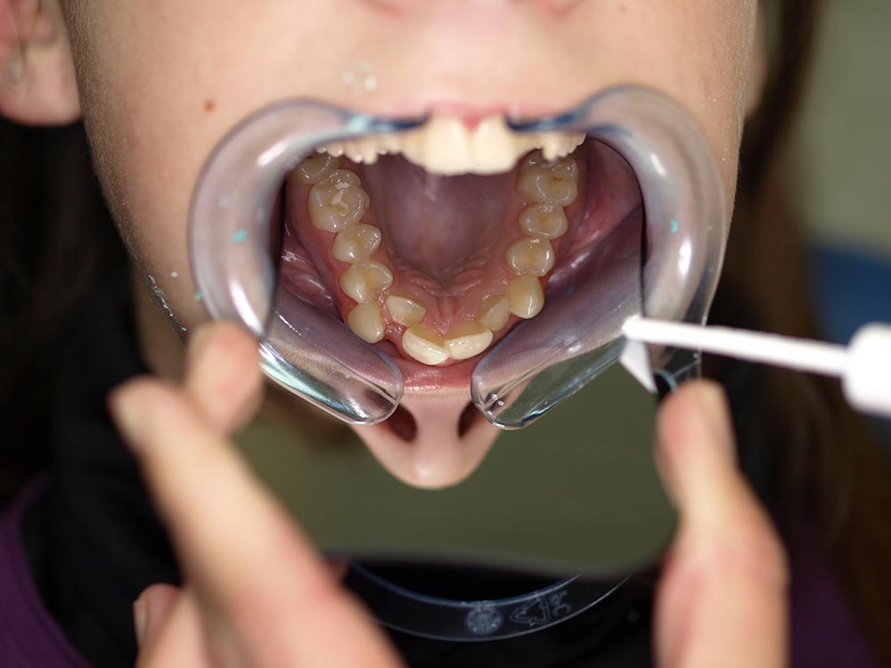 Orthodontic cases