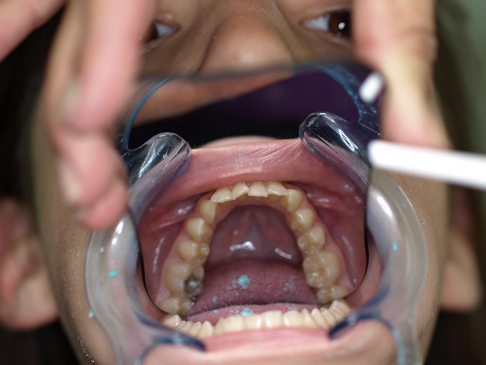 Orthodontic cases