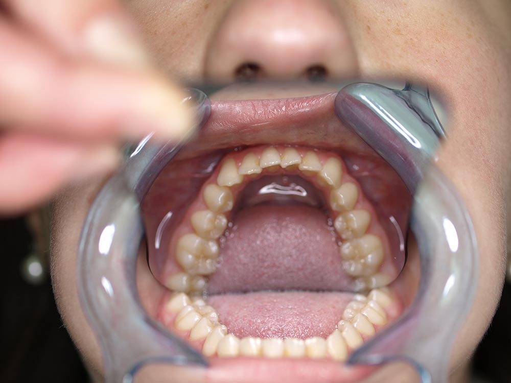 Orthodontic cases