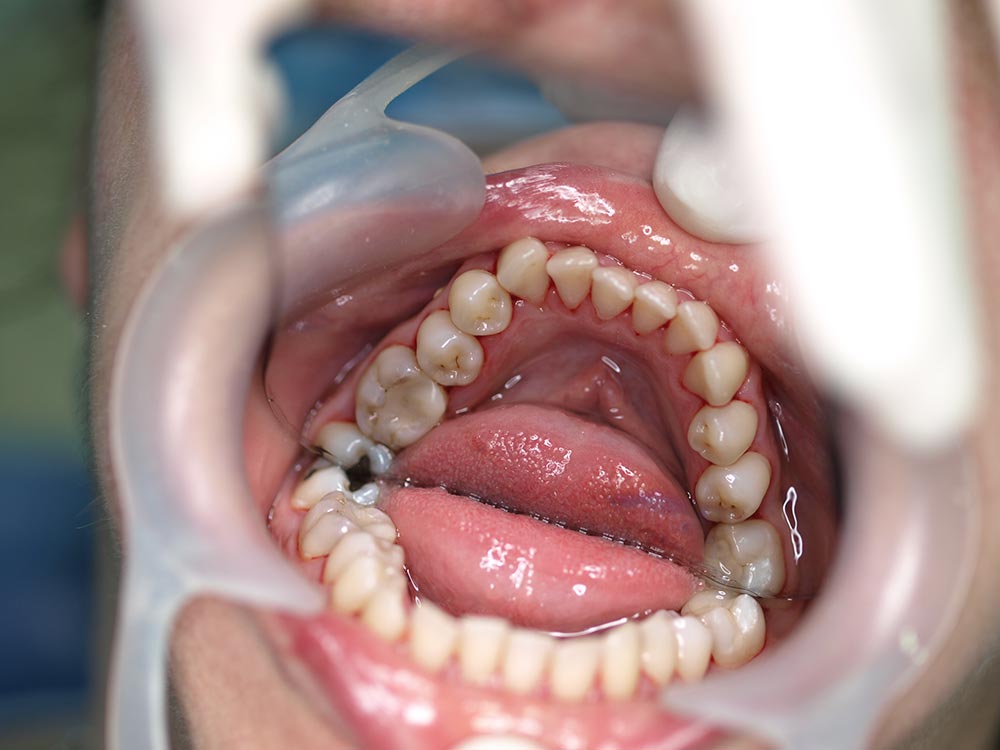 Orthodontic cases