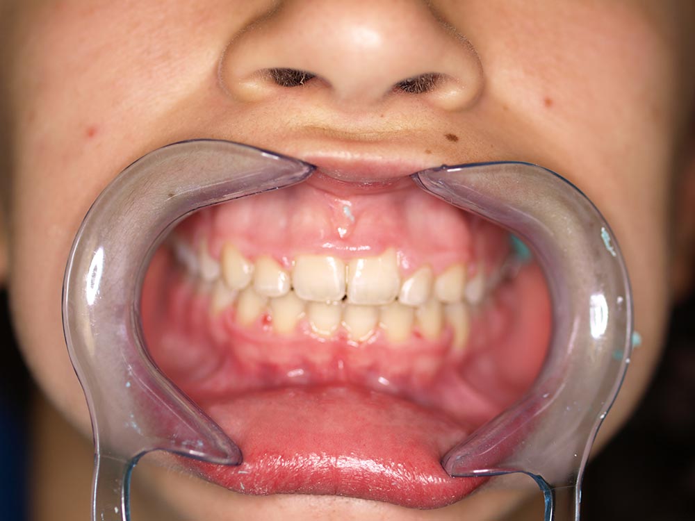 Orthodontic cases