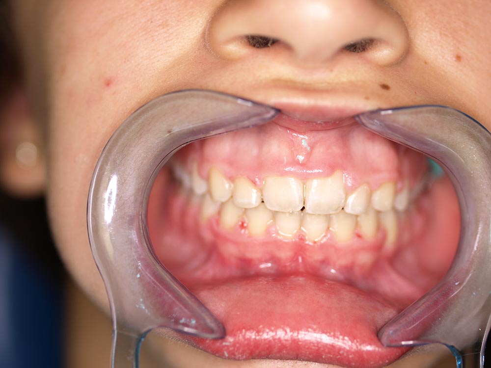 Orthodontic cases