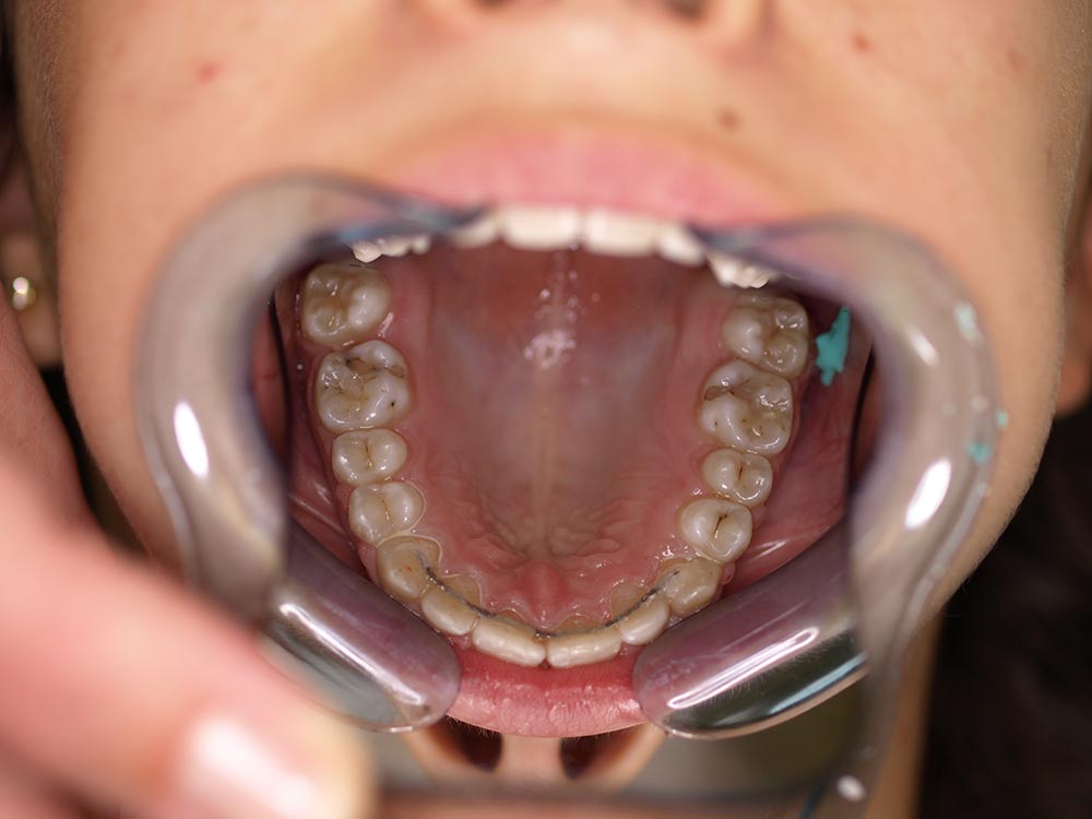 Orthodontic cases