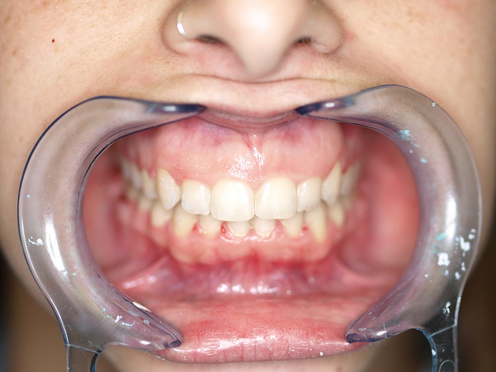 Orthodontic cases