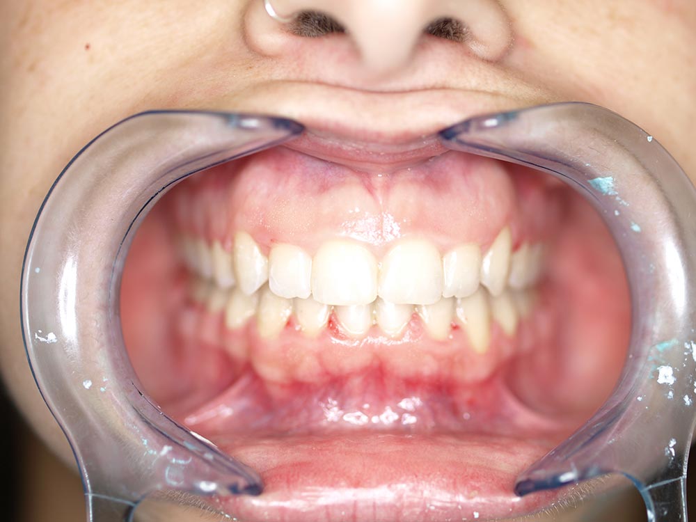 Orthodontic cases