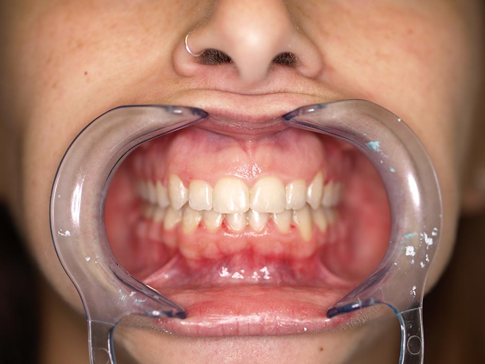 Orthodontic cases