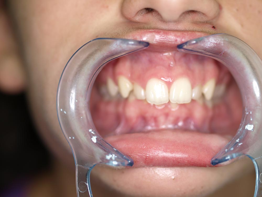 Orthodontic cases