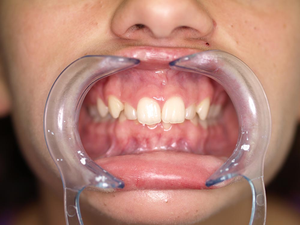 Orthodontic cases