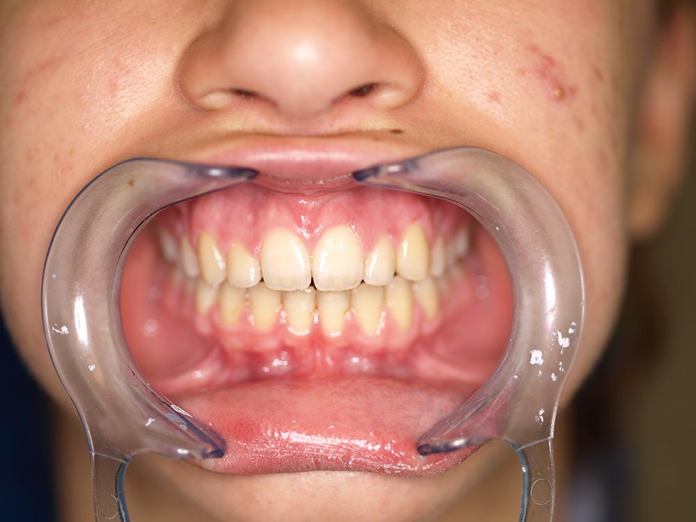 Orthodontic cases