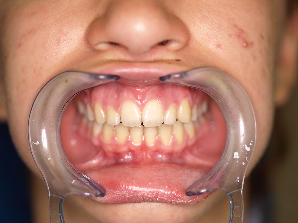 Orthodontic cases