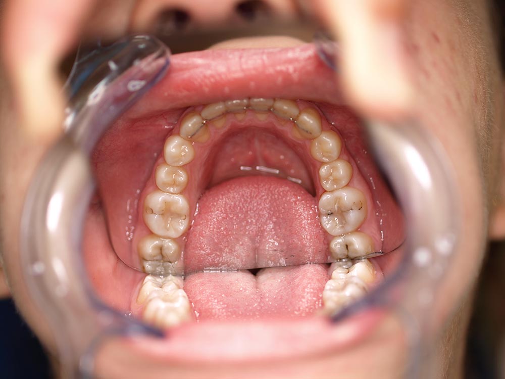 Orthodontic cases