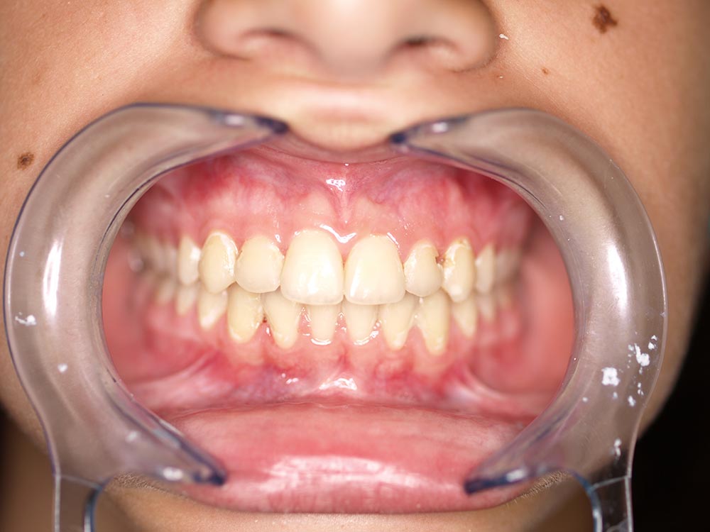 Orthodontic cases