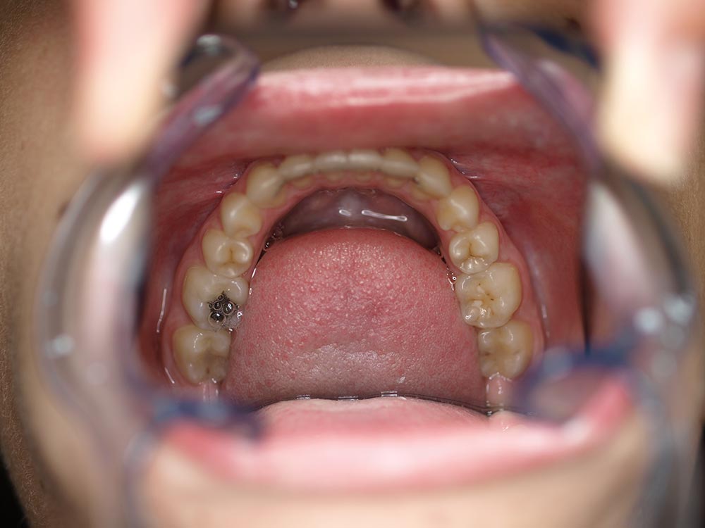 Orthodontic cases