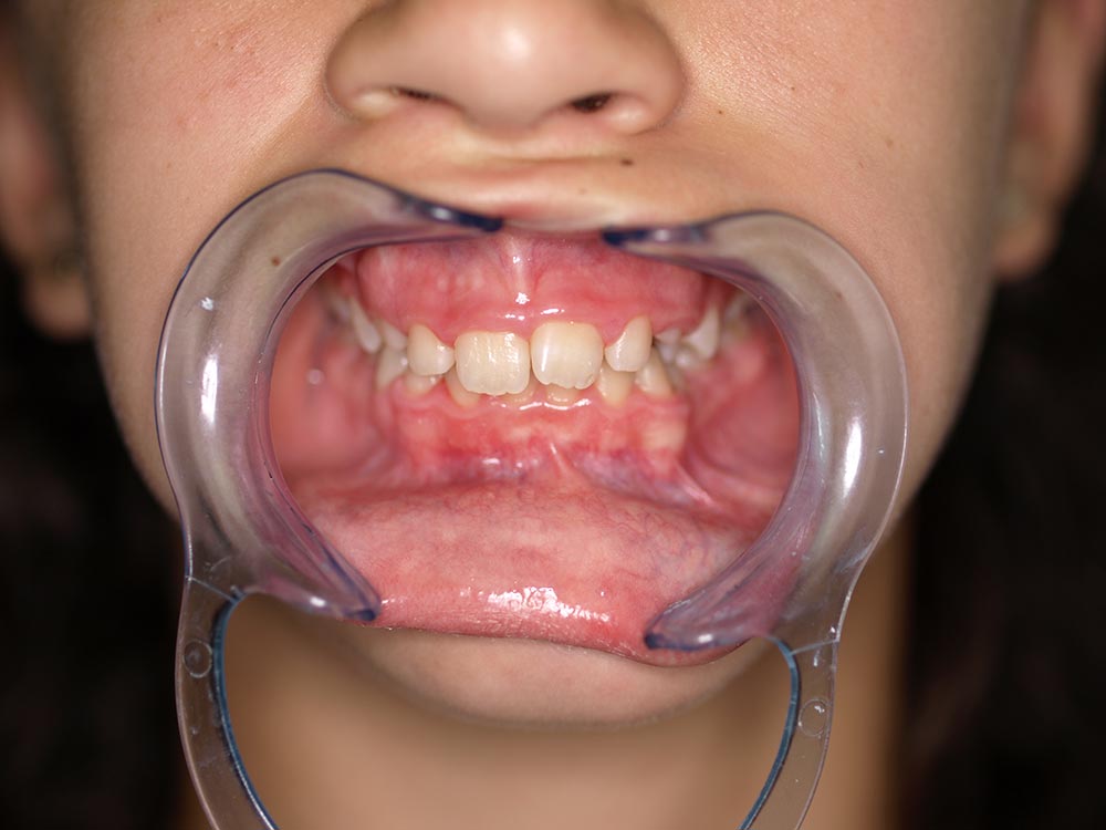 Orthodontic cases