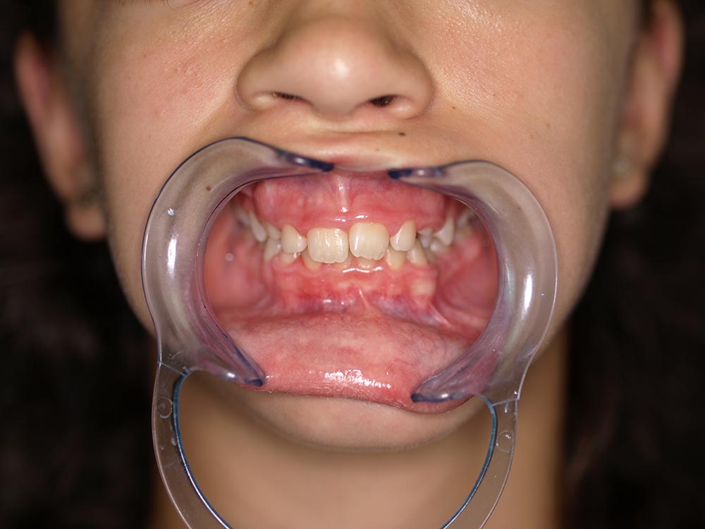 Orthodontic cases